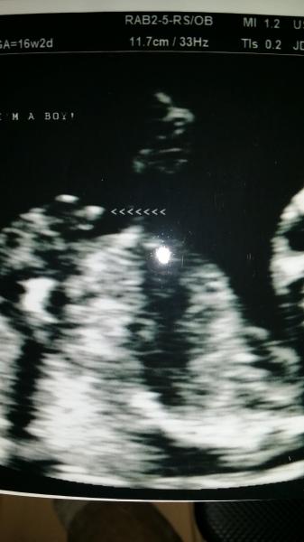 Baby boy?