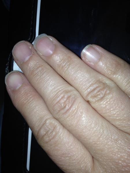 Nail varnish help.