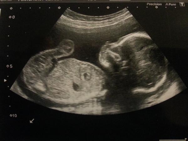 September 2014 - we're over half way there!