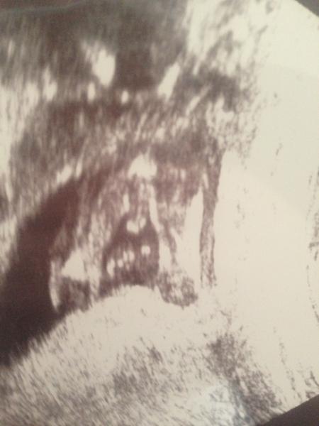 Baby boy?
