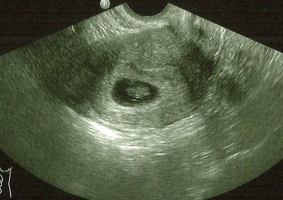 January 2015 - New Year, New Baby, New Thread! #2