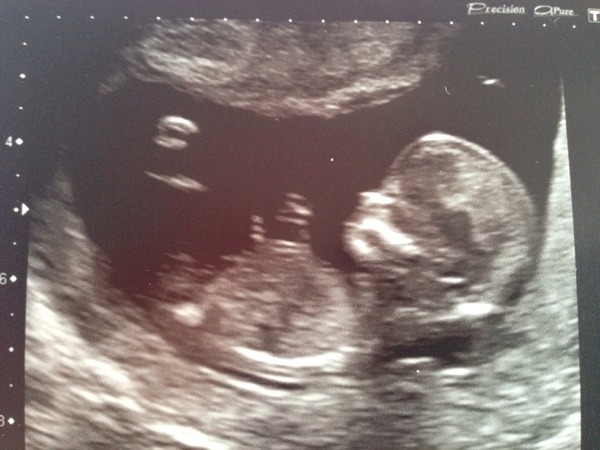 December 2014, Thread #3