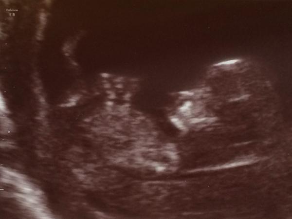 November 2014- thread 4- 12 week scans and blooming in the second trimester!