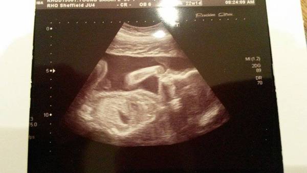 The 'Umm newbie'/ 'Thread maxed out' lovely ladies!