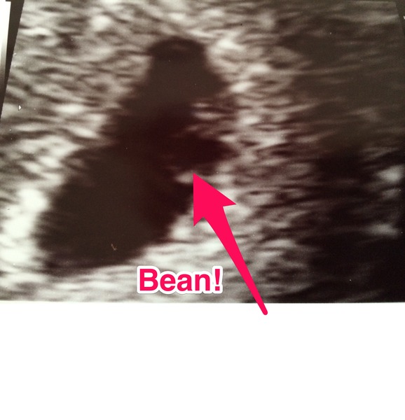 January 2015 - New Year, New Baby, New Thread! #2