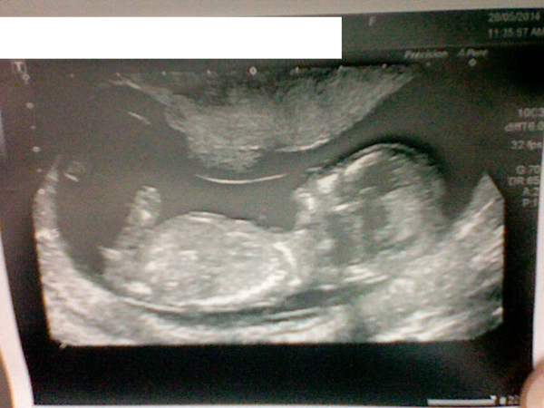 Maybies 2014, babies arriving daily!