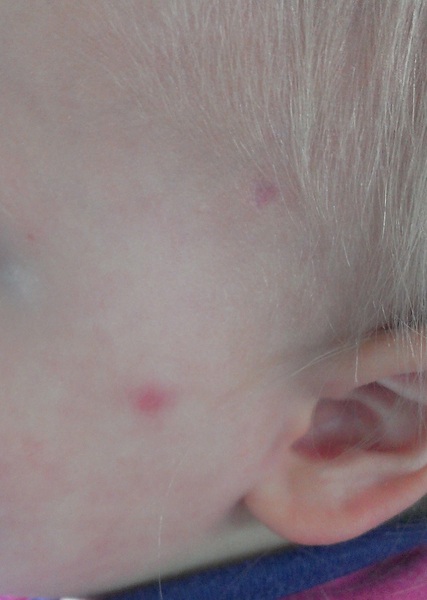 Can anyone help with this mark on DDs face?