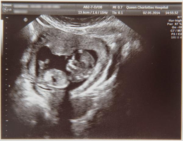 November 2014- thread 4- 12 week scans and blooming in the second trimester!
