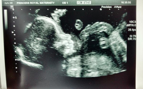 October 2014 - thread 6 - BLUE/PINK/YELLOW the finding out begins!!!