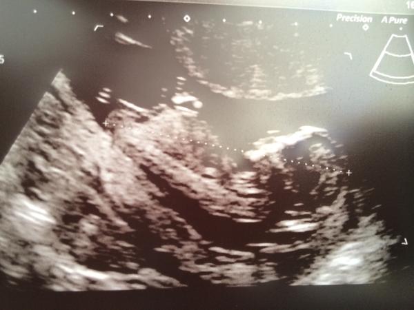 Do you think it's a boy or a girl? Nub theory