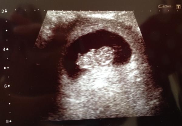 We have fire in our bellies, we're incubating our little Penis Dragons!!