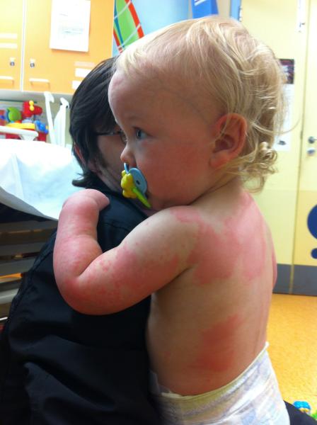 What to expect from allergy clinic appointment