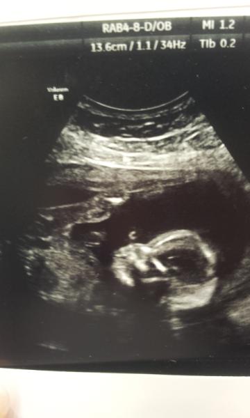 October 2014 - thread 6 - BLUE/PINK/YELLOW the finding out begins!!!