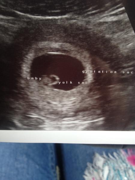 We have fire in our bellies, we're incubating our little Penis Dragons. Thread 2