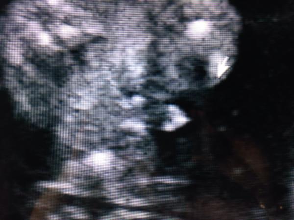 Baby's gender?