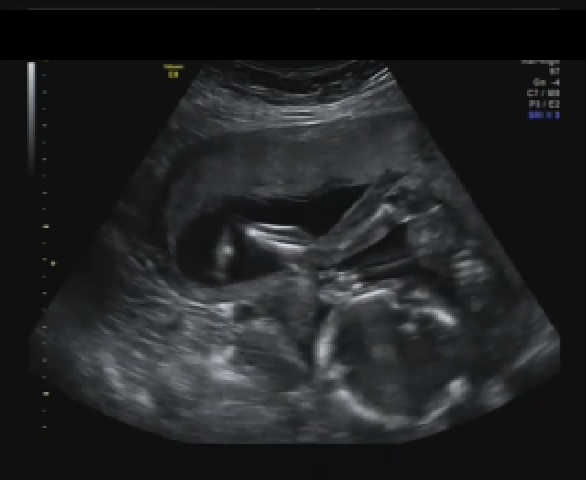 September 2014 - we're over half way there!