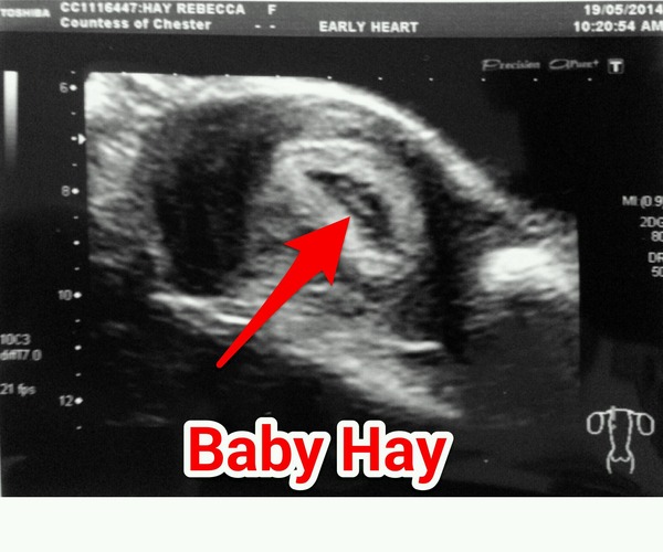 January 2015 - New Year, New Baby, New Thread! #2