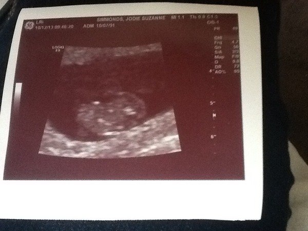 9 week scan pictures?!