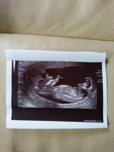 November 2014- thread 4- 12 week scans and blooming in the second trimester!