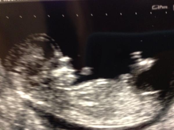 November 1014 - thread 5 - the rainbow collective romping (and limping) into 2nd trimester!