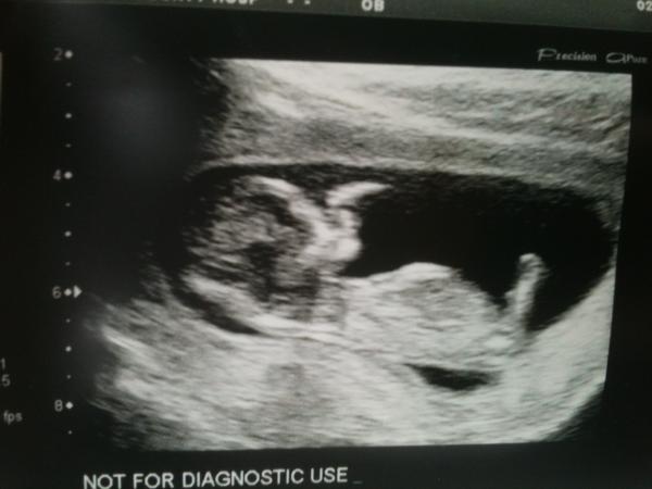 Just Shagging Grads Fred 8! Roll up, roll up, all Viroids welcome!