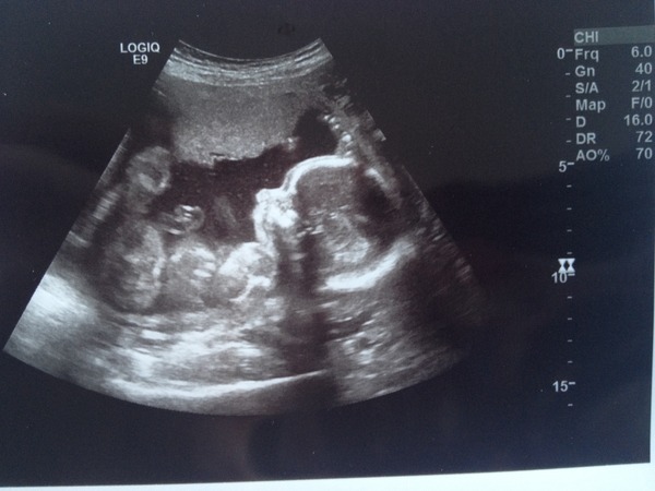 We have fire in our bellies, we're incubating our little Penis Dragons. Thread 2