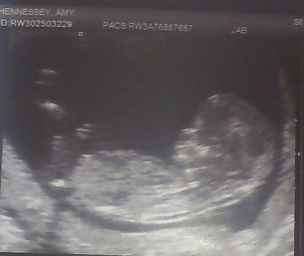 November 2014- thread 4- 12 week scans and blooming in the second trimester!