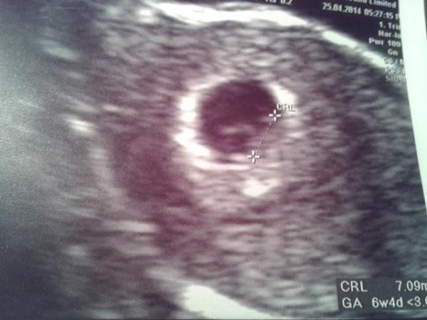 December 2014, Thread #3