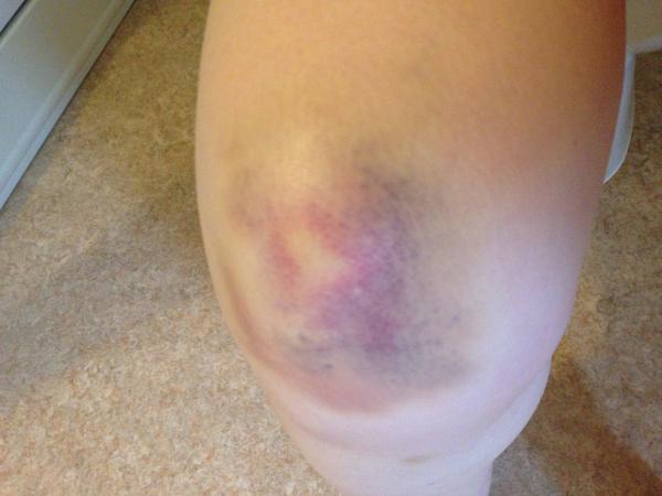 Keep on running - runners thread number 4