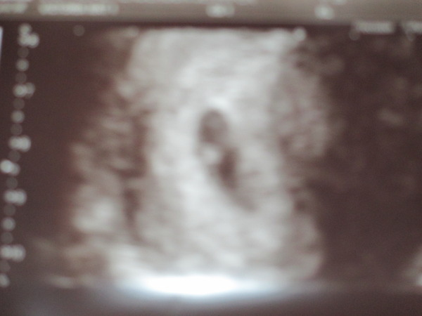 January 2015 - New Year, New Baby, New Thread! #2