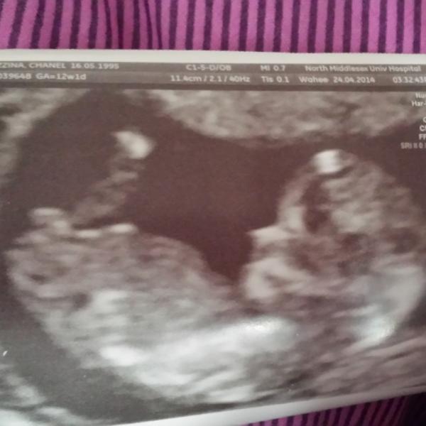 Do you think it's a boy or a girl? Nub theory