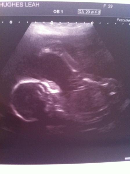 We have fire in our bellies, we're incubating our little Penis Dragons!!