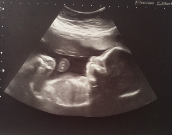 October 2014 - thread 6 - BLUE/PINK/YELLOW the finding out begins!!!