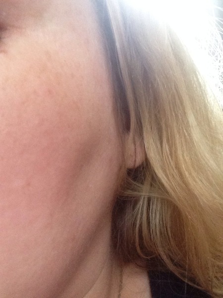 BENEFIT DANDELION- ANY GOOD?