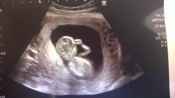 November 2014- thread 4- 12 week scans and blooming in the second trimester!