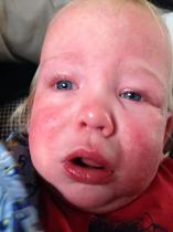 What to expect from allergy clinic appointment