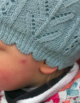Can anyone help with this mark on DDs face?