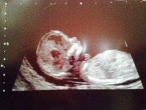 December 2014, Thread #3