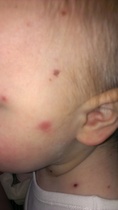 Can anyone help with this mark on DDs face?