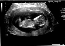 December 2014, Thread #3