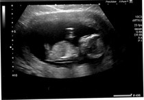 December 2014, Thread #3