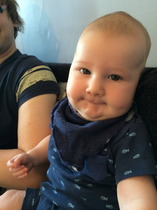 Sorry, me and craniosynostosis again