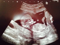 December 2014, Thread #3