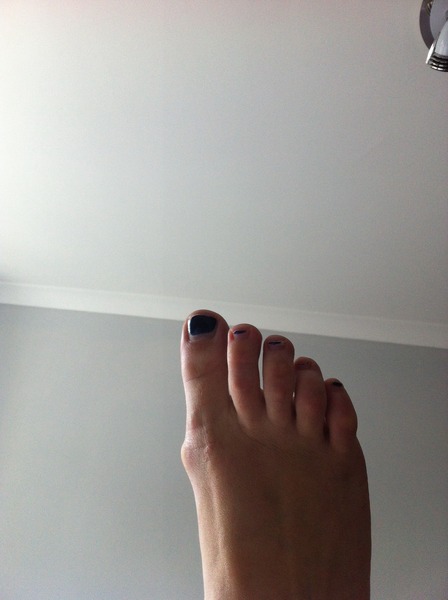 Toenail varnish