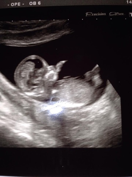 Leaving the first trimester behind and hopefully all the sickness and worry that has come with it. January 2015 thread #5