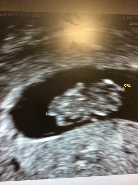 We have fire in our bellies, we're incubating our little Penis Dragons! #3