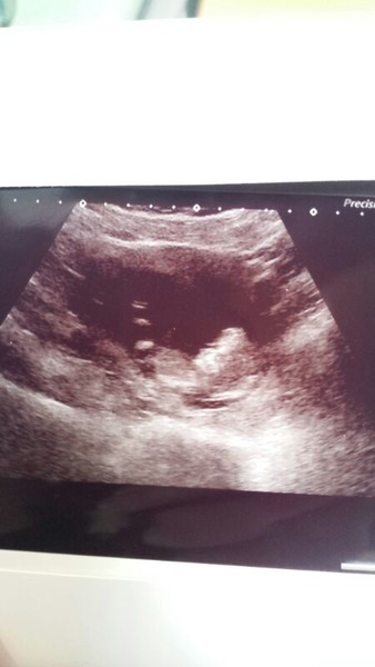 Leaving the first trimester behind and hopefully all the sickness and worry that has come with it. January 2015 thread #5