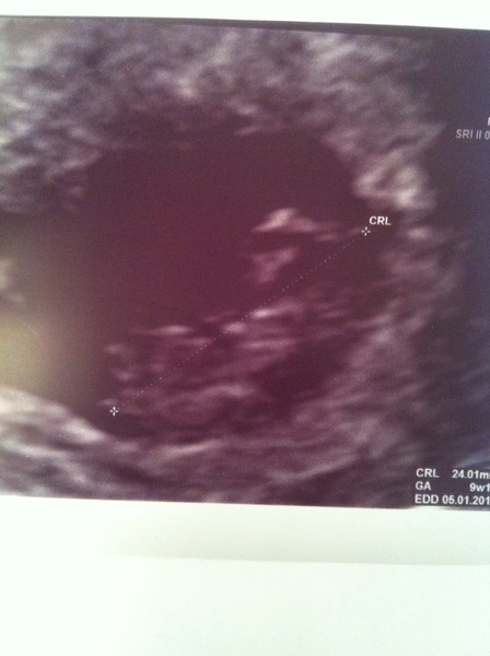 We have fire in our bellies, we're incubating our little Penis Dragons! #3