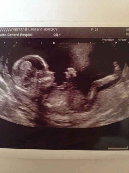 Boy or girl?!?
