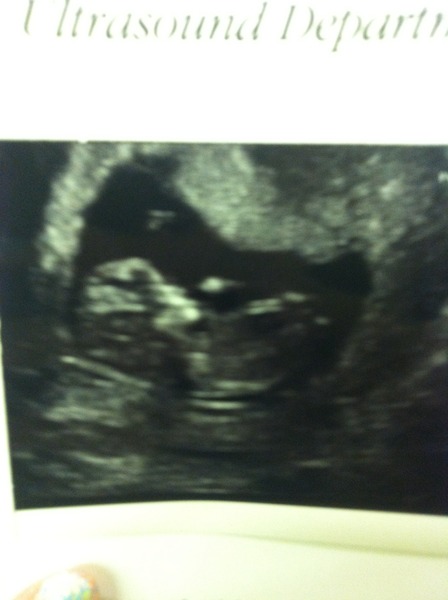 We've got fire in our bellies, we're incubating out little Penis Dragons #4